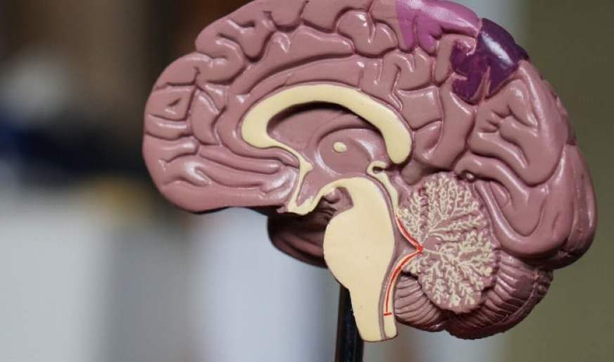  Hoje é o Dia Nacional do Doente com AVC - Jornal do Centro